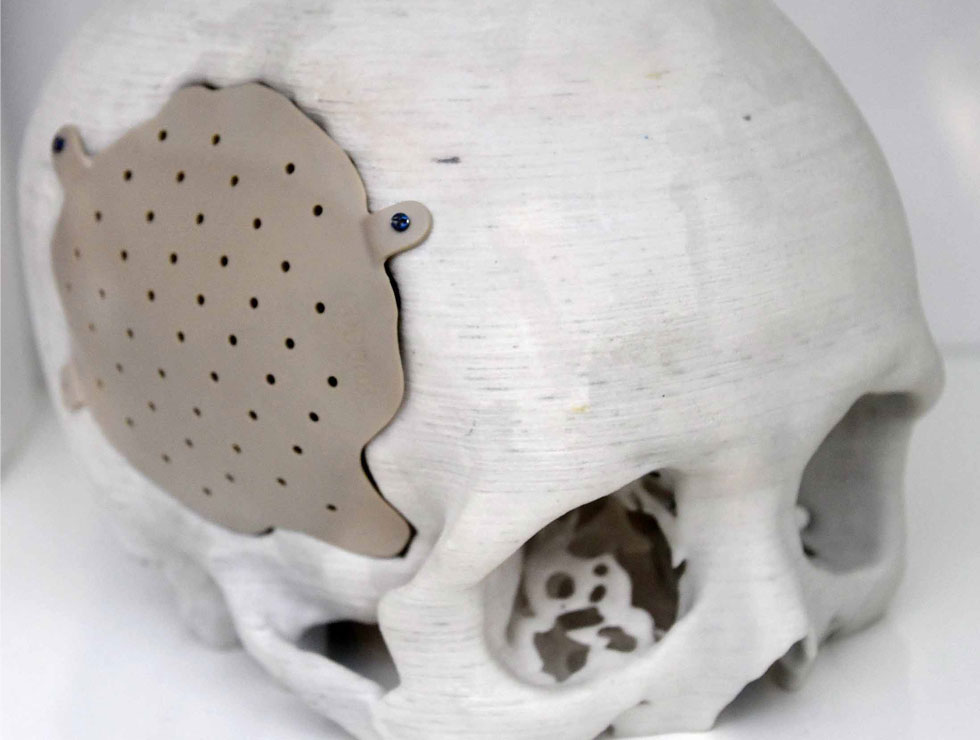 �@������ɫ�ĸ�ˎ��������Ŀ��������3D��ӡ���XĤ��